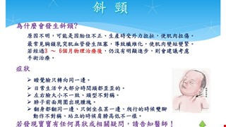 斜頸