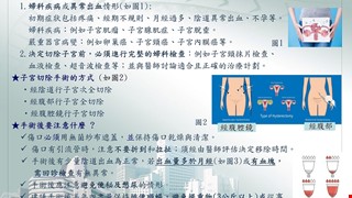 認識子宮切除手術