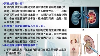 認識經皮腎臟鏡取石手術