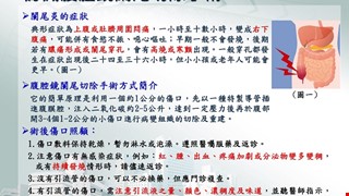 認識腹腔鏡闌尾切除手術
