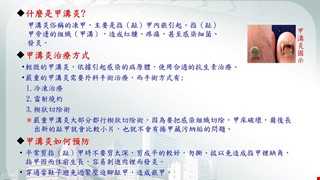 認識甲溝炎