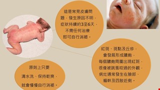 新生兒毒性紅斑是什麼