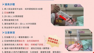 鼻胃管灌食