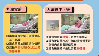 鼻胃管灌食注意事項