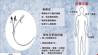 認識中心靜脈導管