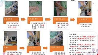 鼻胃管灌食