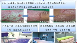 水療