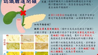 認識膽道閉鎖