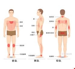 壓力性損傷的預防與治療