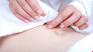 Acupuncture indications那些疾病適合針灸治療呢？