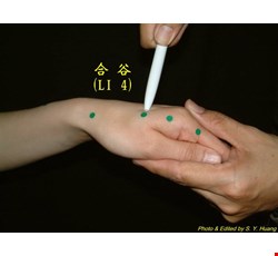 Nursing Instructions of Acupressure for Pediatric Cerebral Palsy 小兒腦癱穴位按摩護理指導