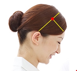 Traditional Chinese Medicine Treatment for Head Injury 頭部外傷中醫治療