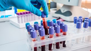 Procedures for Blood Collection in the Hospital and Self-testing of Blood Sugar Levels 醫院抽血及自我檢驗血糖的程序