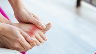 Gout and Hyperuricemia 痛風與高尿酸血症