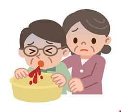 Upper Gastrointestinal Bleeding 上消化道出血