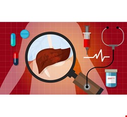 Liver Abscess 肝膿瘍