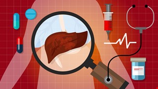 Acute Hepatitis 急性肝炎