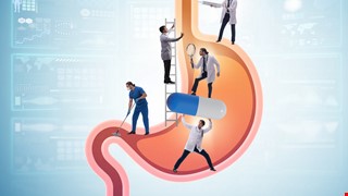 Gastric Ulcer and Triple Therapy or Quadruple Therapy 胃潰瘍及三合一或四合一治療