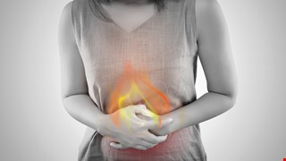 Gastroesophageal Reflux Disease 胃食道逆流