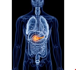 Acute Pancreatitis Therapy and Prevention 急性胰腺炎治療及預防
