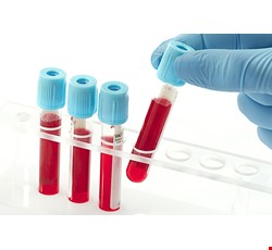 Arterial blood gas analysis 動脈血液氣體分析