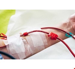 How to Protect Your Vascular Access 如何保護您的洗腎血管通路