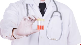 Hematuria 什麼是血尿？