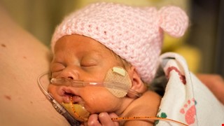 The Premature Infant 早產兒常見的合併症