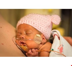 The Premature Infant 早產兒常見的合併症