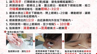 如何正確使用眼藥水及眼藥膏/5A