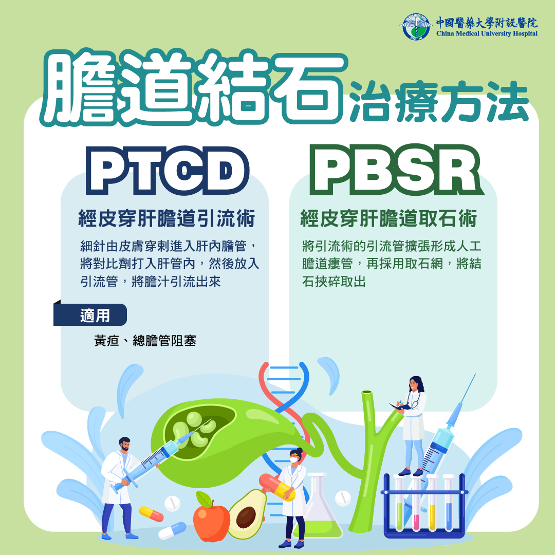 膽道結石常見檢查