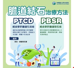 膽道結石常見檢查