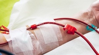 Types of Vascular Access for Hemodialysis 淺談血液透析血管通路種類