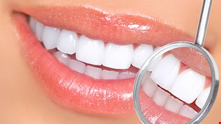 Teeth Whitening 談牙齒美白