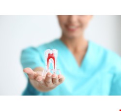 Root Canal Therapy 根管治療