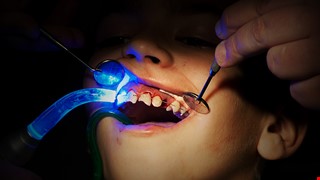Notes After Dental Injury 牙齒外傷後注意事項