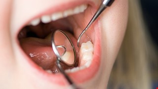 Health Education for Dental Trauma in Children 兒童牙科外傷衛教