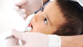 What Are Pit-and-Fissure Sealants 什麼是窩溝封填？