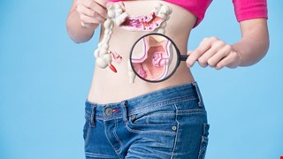 Colorectal Cancer Prevention 預防大腸直腸癌