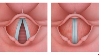 Voice Health Care 淺談嗓音保健
