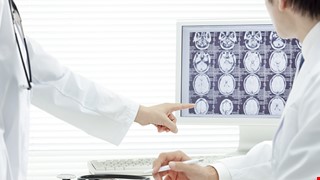 Cerebrovascular accident (CVA) or Stroke 腦中風