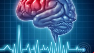 Electroencephalography（EEG）腦波檢查須知