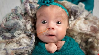 The treatment for residual milk with nasogastric tube feeding 小兒鼻胃管灌食餘奶之處理