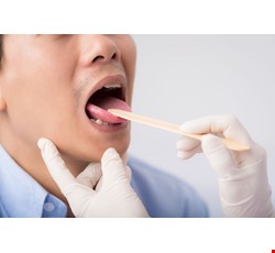 Early Diagnosis of Oral Cancer by Oral Self-examination 口腔自我檢查 早期診斷口腔癌