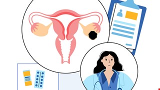 Ovarian benign tumor 認識卵巢良性腫瘤