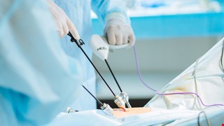 The matters about the Laparoscopy caring 腹腔鏡手術照護須知