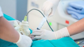 Amniocentesis 認識羊膜穿刺檢查