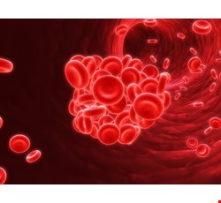 Thalassemia 地中海型貧血