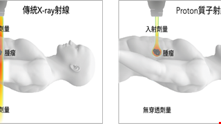 Advantages of Proton Therapy 質子治療的優勢