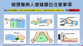 燒燙傷病人復健擺位注意事項/BURN
